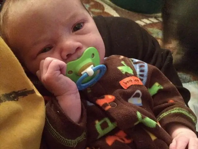 Alterations in breast structure post-pregnancy and during lactation