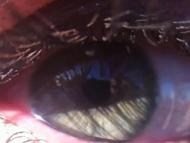 Eye Disorder: Signs, Root Causes, and Remedies