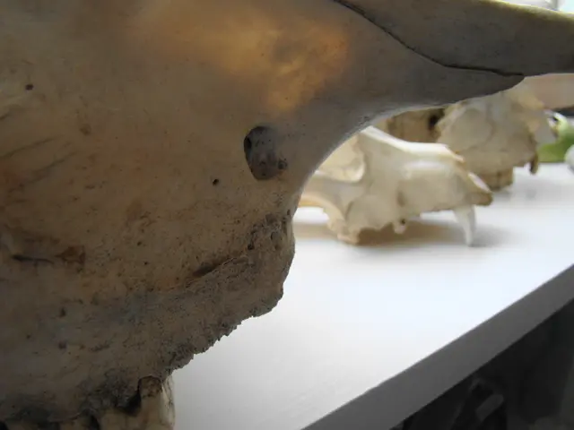 The Essence of Radiation: An Explanation