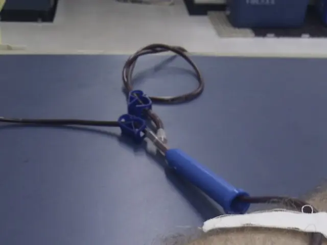 Dialysis: A Process for Cleaning Toxins from the Blood in Kidney Failure