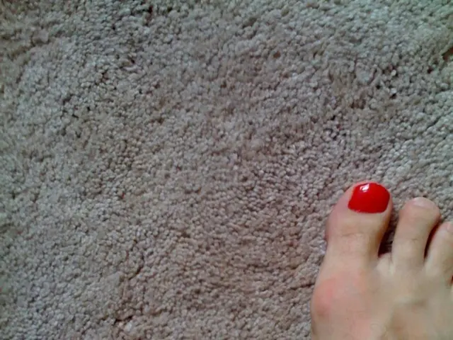 Understanding Peripheral Vascular Disease: An Explanation