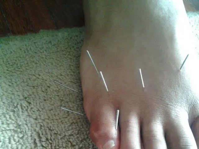 In this image I can see the person´s leg and I can see few needles and I can see the mat in cream...